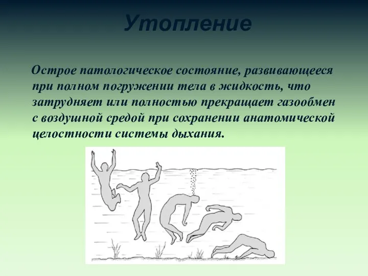 Утопление Острое патологическое состояние, развивающееся при полном погружении тела в жидкость,