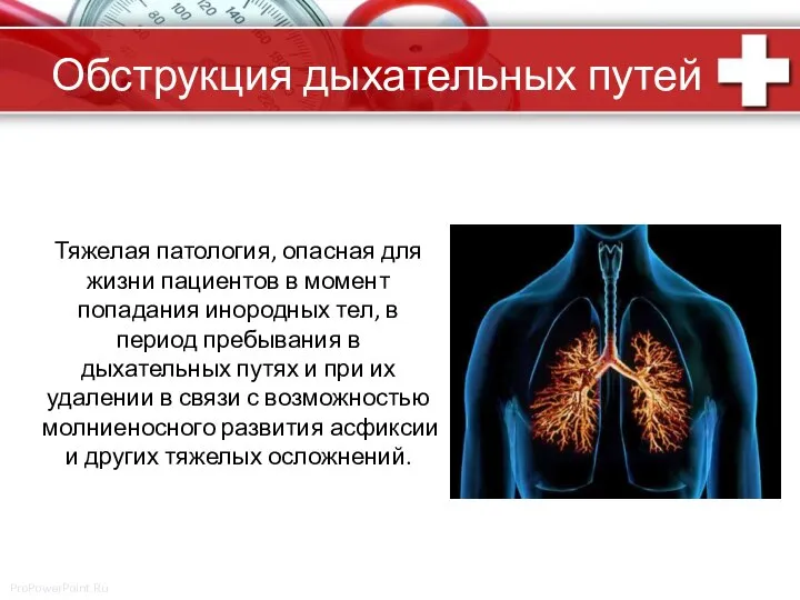 Обструкция дыхательных путей Тяжелая патология, опасная для жизни пациентов в момент