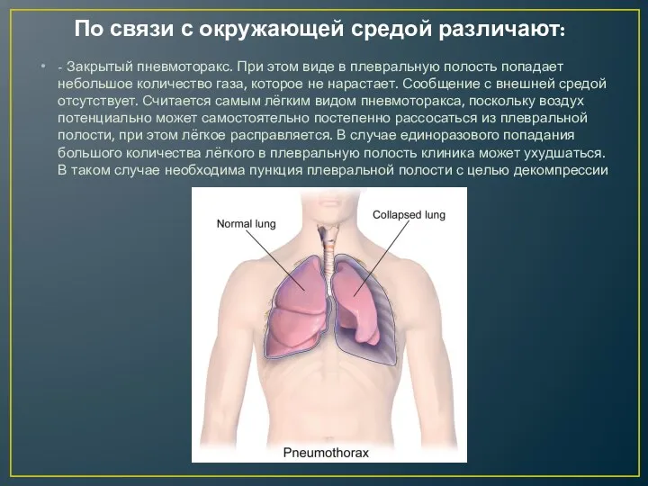 По связи с окружающей средой различают: - Закрытый пневмоторакс. При этом