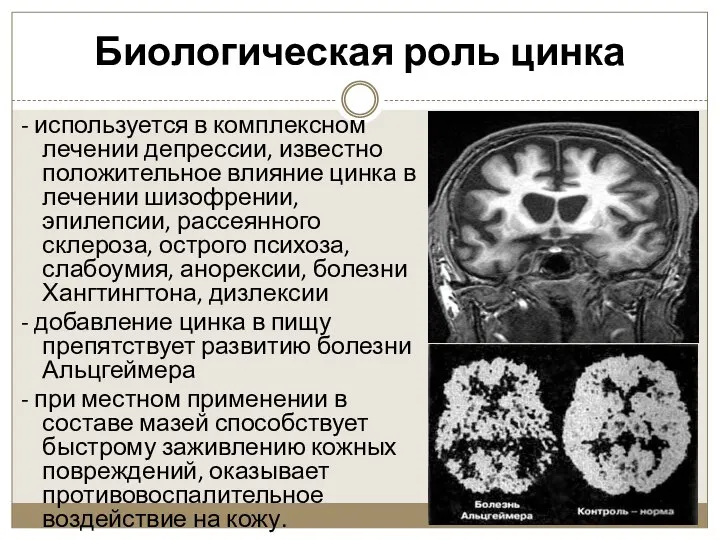 Биологическая роль цинка - используется в комплексном лечении депрессии, известно положительное