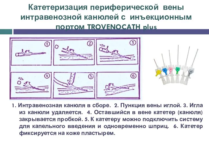 Катетеризация периферической вены интравенозной канюлей с инъекционным портом TROVENOCATH plus 1.