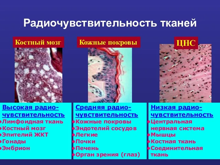 Радиочувствительность тканей Костный мозг Кожные покровы ЦНС Высокая радио-чувствительность Лимфоидная ткань