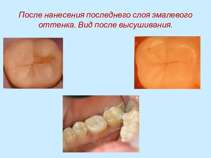 После нанесения последнего слоя эмалевого оттенка. Вид после высушивания.