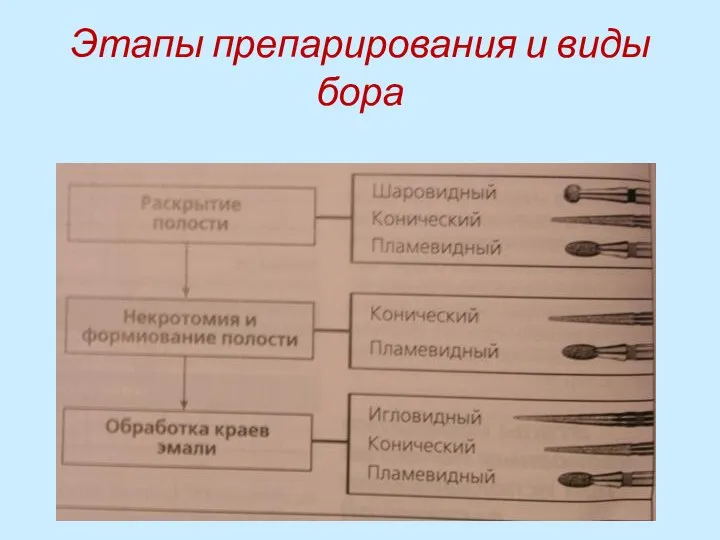 Этапы препарирования и виды бора