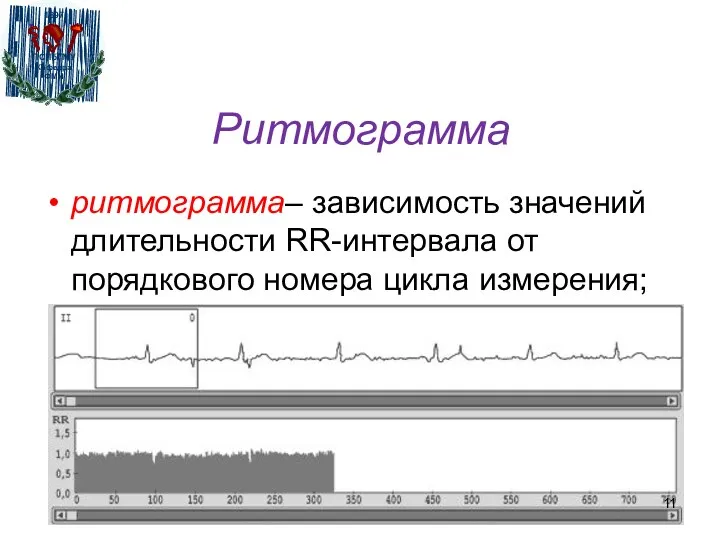 Ритмограмма ритмограмма– зависимость значений длительности RR-интервала от порядкового номера цикла измерения;