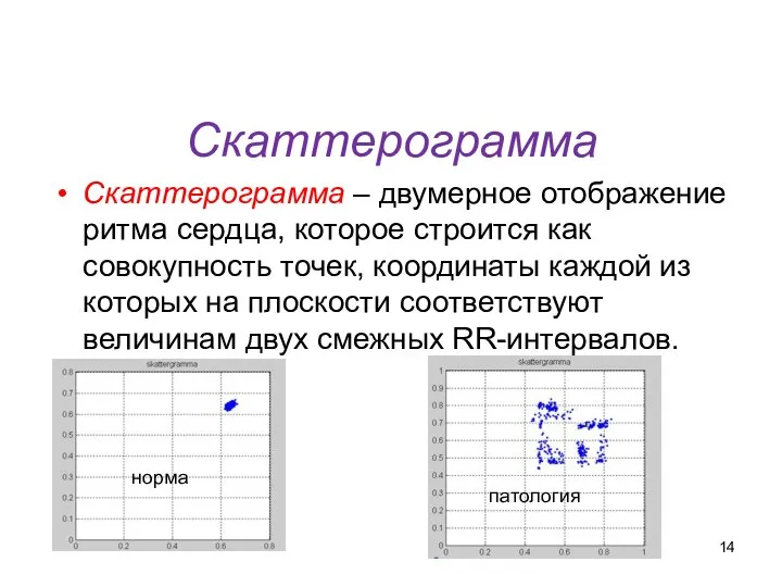 Скаттерограмма Скаттерограмма – двумерное отображение ритма сердца, которое строится как совокупность