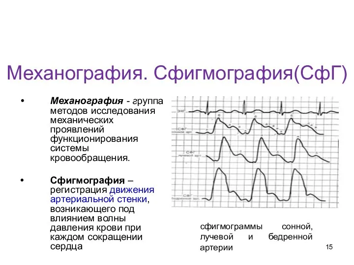 Механография. Сфигмография(СфГ) Механография - группа методов исследования механических проявлений функционирования системы