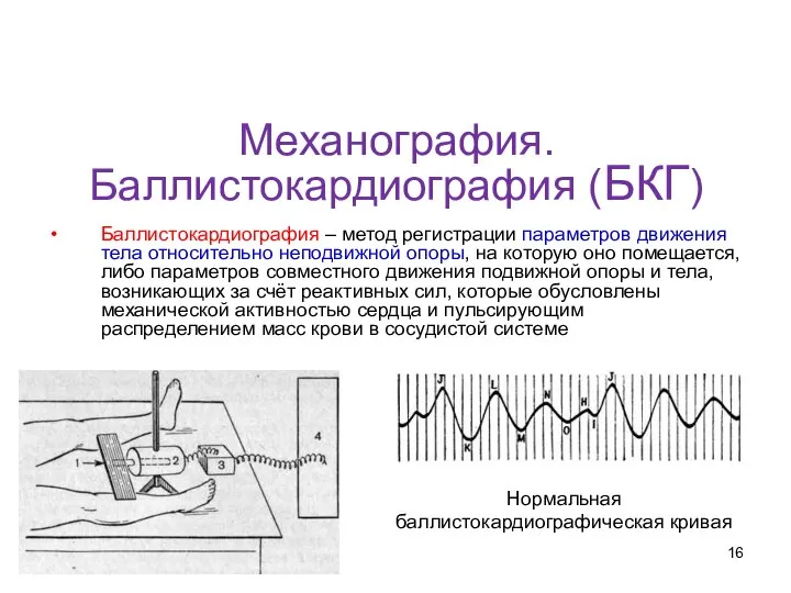 Механография. Баллистокардиография (БКГ) Баллистокардиография – метод регистрации параметров движения тела относительно
