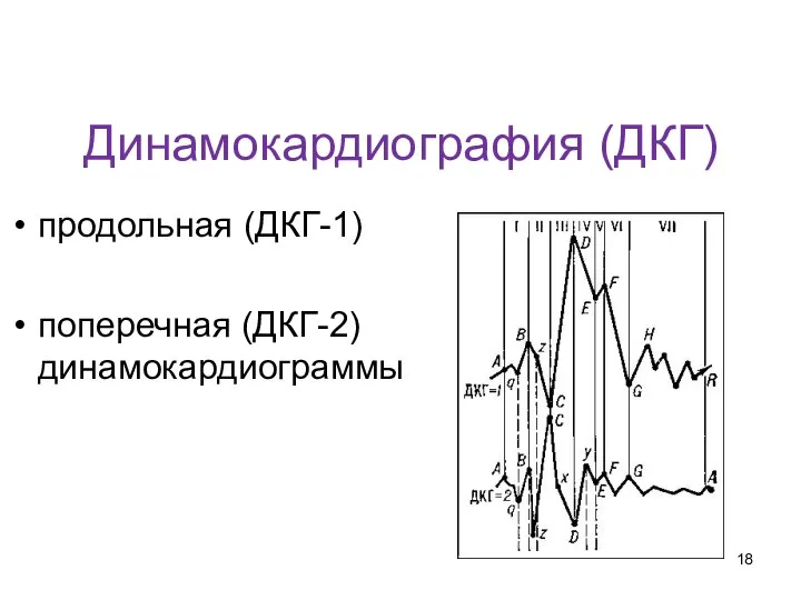 Динамокардиография (ДКГ) продольная (ДКГ-1) поперечная (ДКГ-2) динамокардиограммы