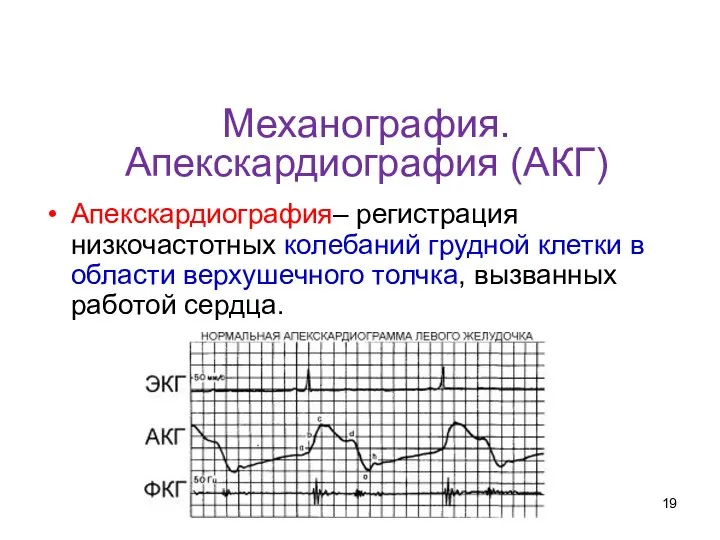 Механография. Апекскардиография (АКГ) Апекскардиография– регистрация низкочастотных колебаний грудной клетки в области верхушечного толчка, вызванных работой сердца.
