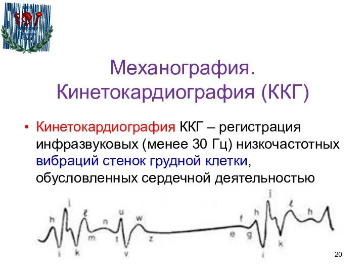 Механография. Кинетокардиография (ККГ) Кинетокардиография ККГ – регистрация инфразвуковых (менее 30 Гц)