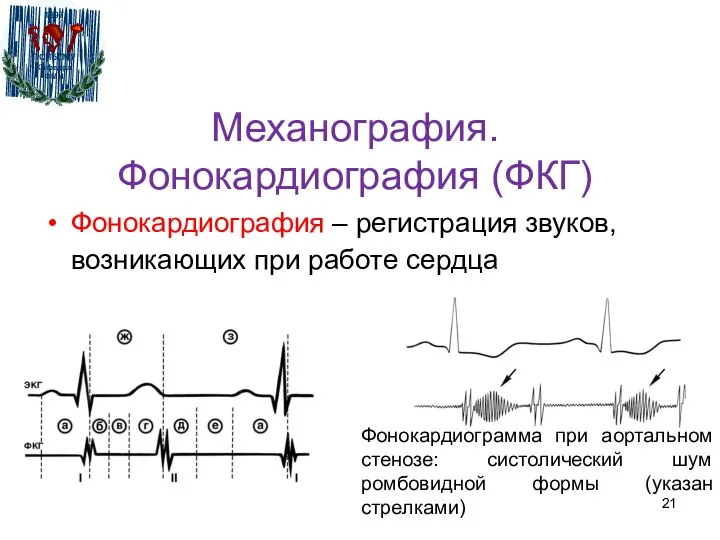 Механография. Фонокардиография (ФКГ) Фонокардиография – регистрация звуков, возникающих при работе сердца