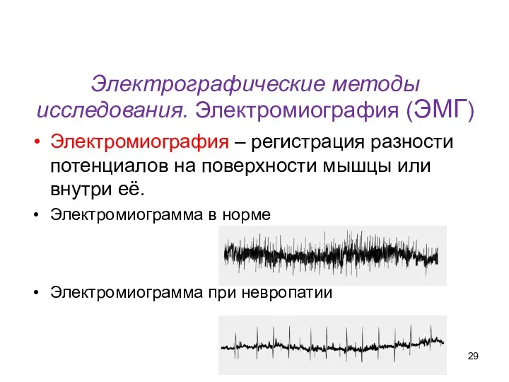 Электрографические методы исследования. Электромиография (ЭМГ) Электромиография – регистрация разности потенциалов на