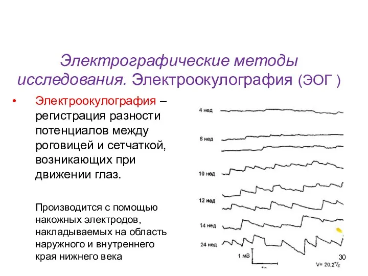 Электрографические методы исследования. Электроокулография (ЭОГ ) Электроокулография – регистрация разности потенциалов