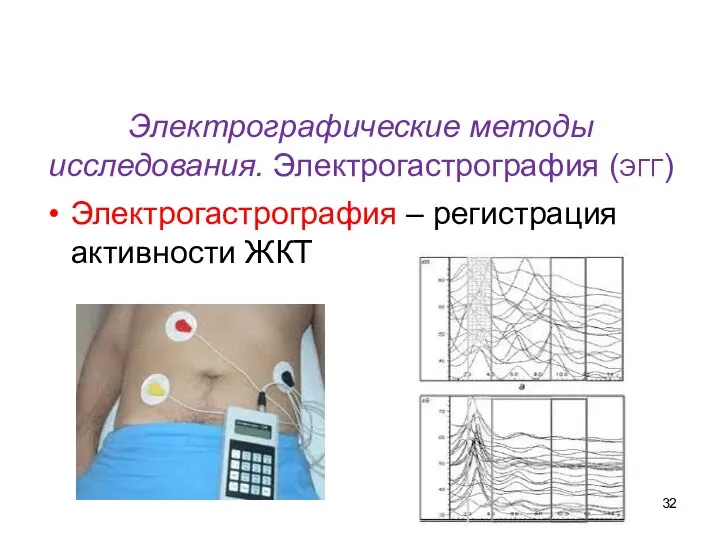 Электрографические методы исследования. Электрогастрография (ЭГГ) Электрогастрография – регистрация активности ЖКТ