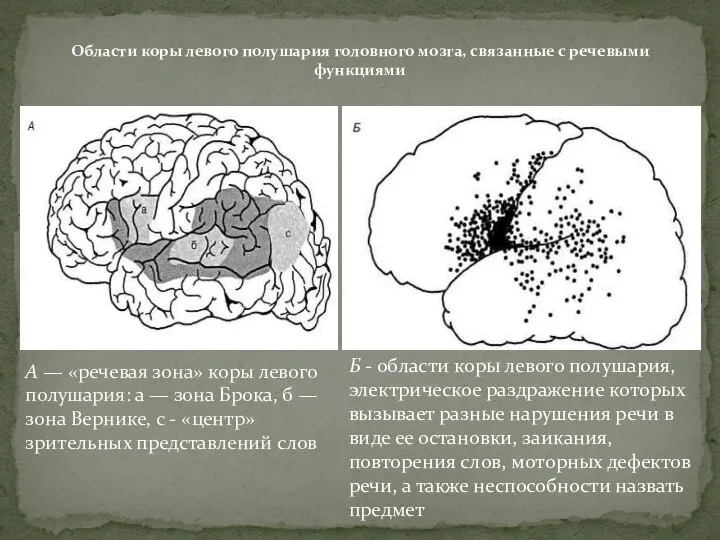 А — «речевая зона» коры левого полушария: а — зона Брока,