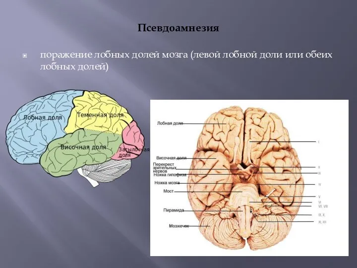 Псевдоамнезия поражение лобных долей мозга (левой лобной доли или обеих лобных долей)