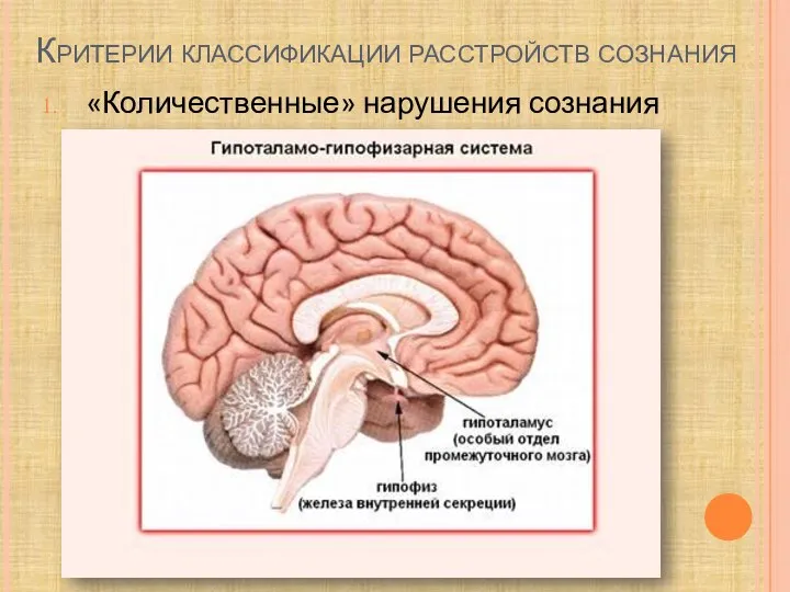 Критерии классификации расстройств сознания «Количественные» нарушения сознания