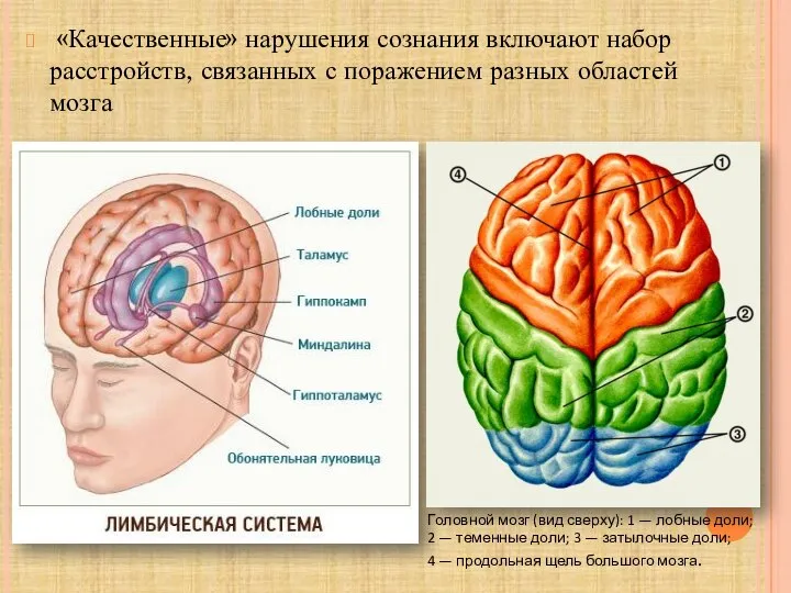 «Качественные» нарушения сознания включают набор расстройств, связанных с поражением разных областей