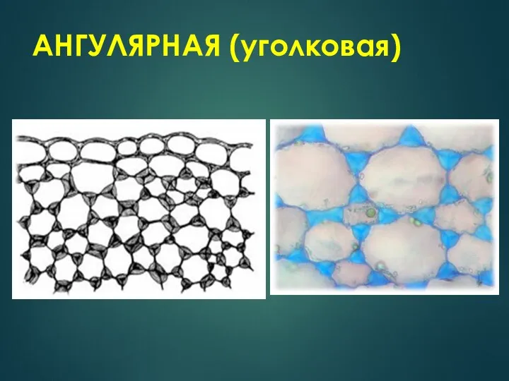 АНГУЛЯРНАЯ (уголковая)