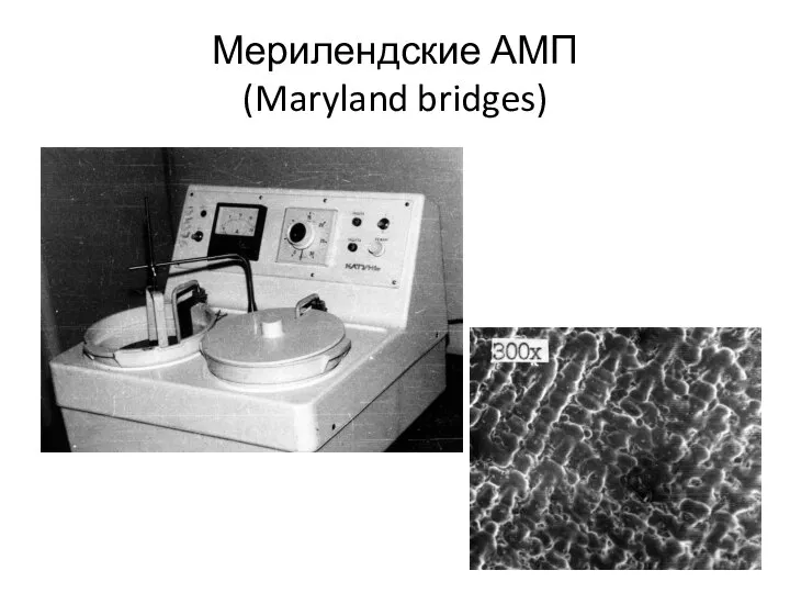Мерилендские АМП (Maryland bridges)