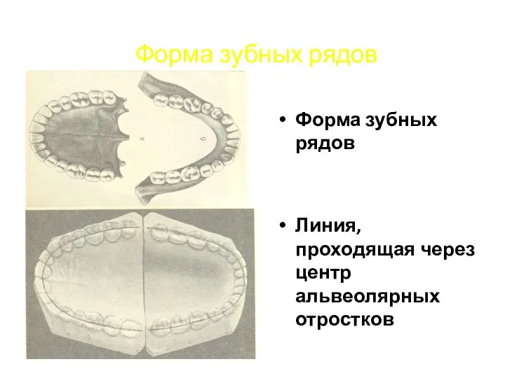 Форма зубных рядов Форма зубных рядов Линия, проходящая через центр альвеолярных отростков