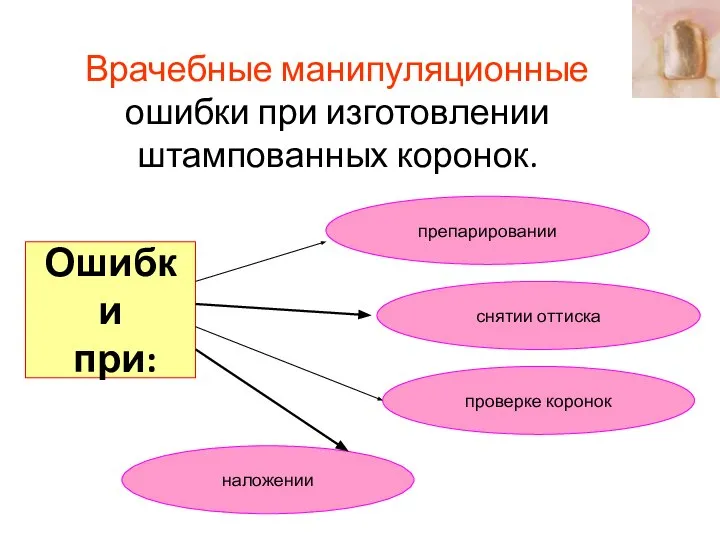 Врачебные манипуляционные ошибки при изготовлении штампованных коронок. Ошибки при: проверке коронок наложении снятии оттиска препарировании