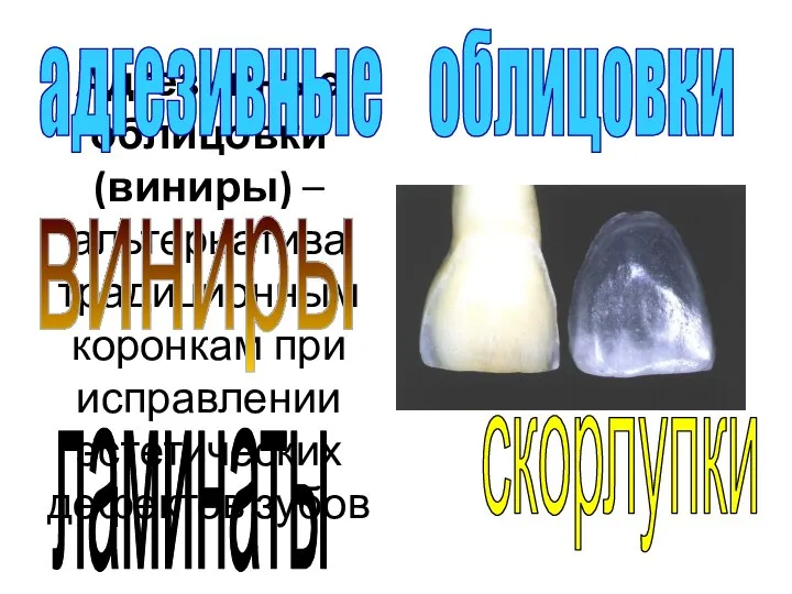 Адгезивные облицовки (виниры) –альтернатива традиционным коронкам при исправлении эстетических дефектов зубов ламинаты скорлупки виниры адгезивные облицовки