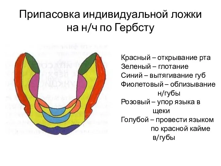 Припасовка индивидуальной ложки на н/ч по Гербсту Красный – открывание рта