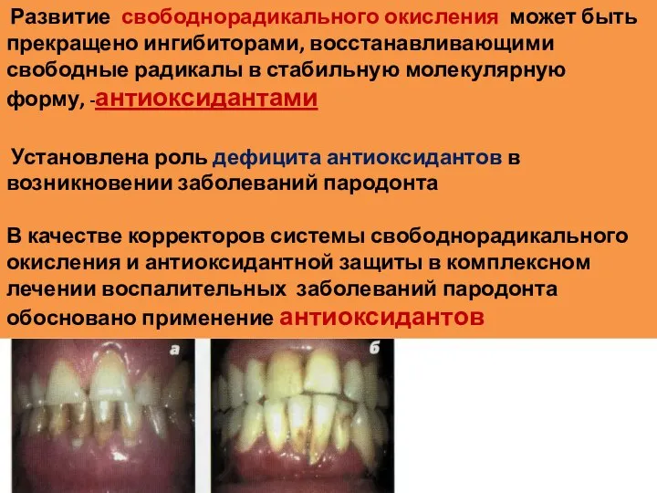 Развитие свободнорадикального окисления может быть прекращено ингибиторами, восстанавливающими свободные радикалы в