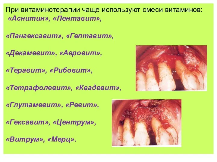 При витаминотерапии чаще используют смеси витаминов: «Аснитин», «Пентавит», «Пангексавит», «Гептавит», «Декамевит»,
