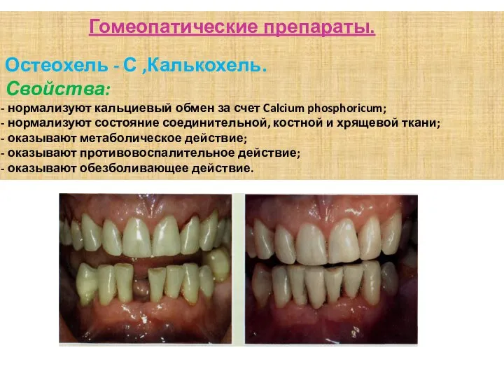 Гомеопатические препараты. Остеохель - С ,Калькохель. Свойства: нормализуют кальциевый обмен за