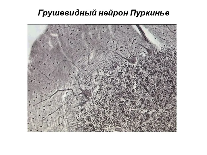 Грушевидный нейрон Пуркинье