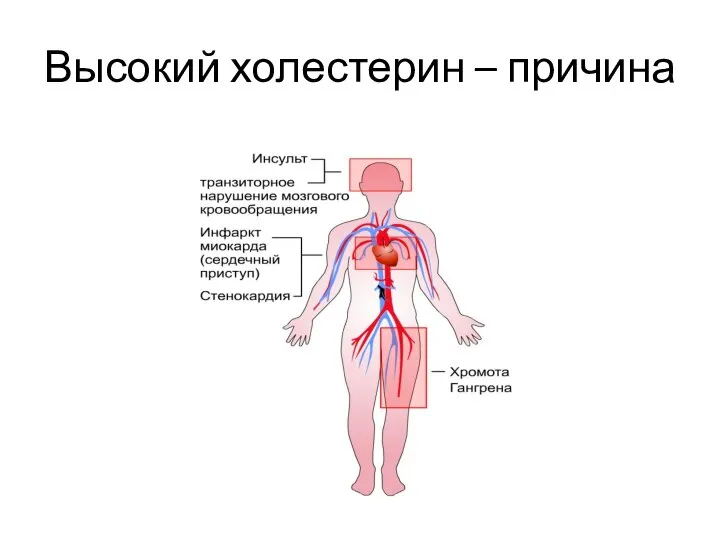 Высокий холестерин – причина