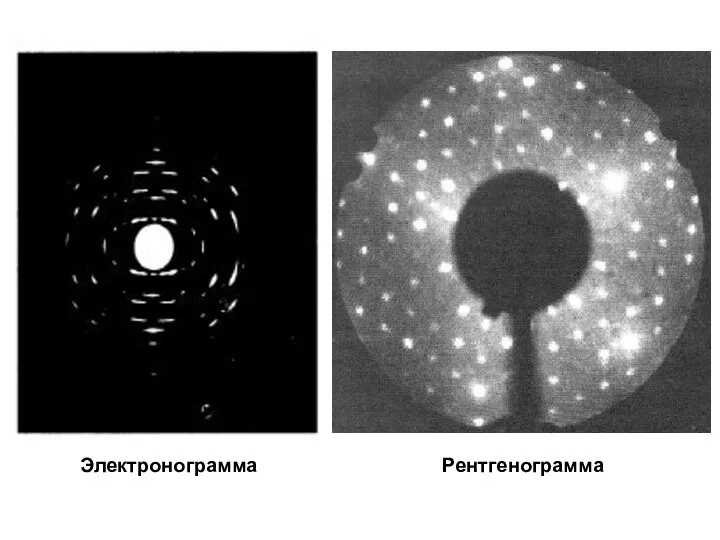Электронограмма Рентгенограмма