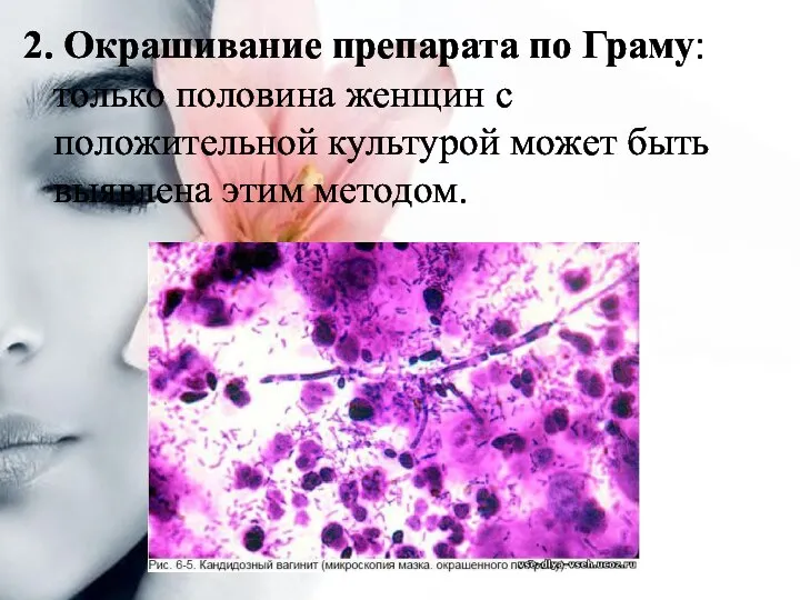 2. Окрашивание препарата по Граму: только половина женщин с положительной культурой может быть выявлена этим методом.