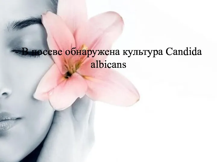 - В посеве обнаружена культура Candida albicans