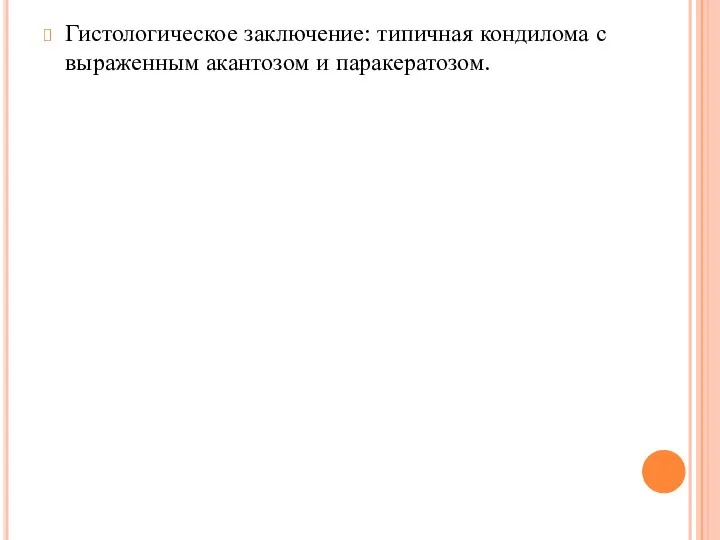 Гистологическое заключение: типичная кондилома с выраженным акантозом и паракератозом.