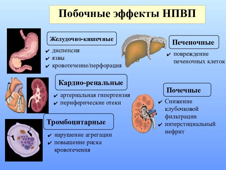 Побочные эффекты НПВП