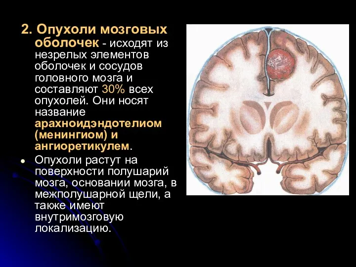 2. Опухоли мозговых оболочек - исходят из незрелых элементов оболочек и