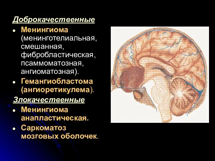 Доброкачественные Менингиома (менинготелиальная, смешанная, фибробластическая, псаммоматозная, ангиоматозная). Гемангиобластома (ангиоретикулема). Злокачественные Менингиома анапластическая. Саркоматоз мозговых оболочек.