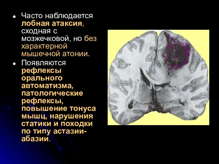 Часто наблюдается лобная атаксия, сходная с мозжечковой, но без характерной мышечной