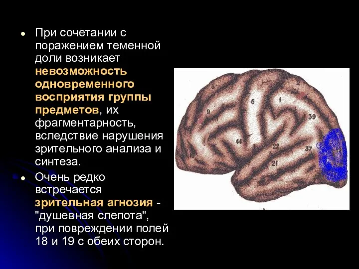 При сочетании с поражением теменной доли возникает невозможность одновременного восприятия группы