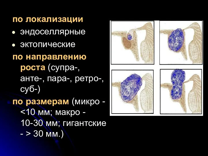 по локализации эндоселлярные эктопические по направлению роста (супра-, анте-, пара-, ретро-,