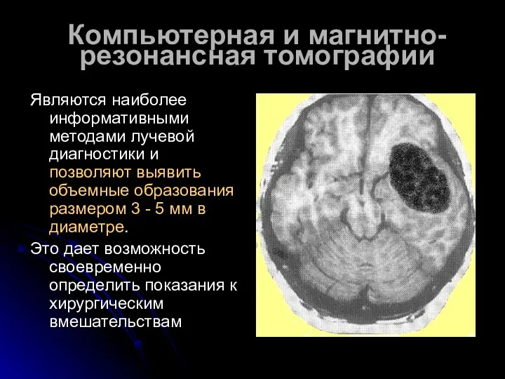 Компьютерная и магнитно-резонансная томографии Являются наиболее информативными методами лучевой диагностики и