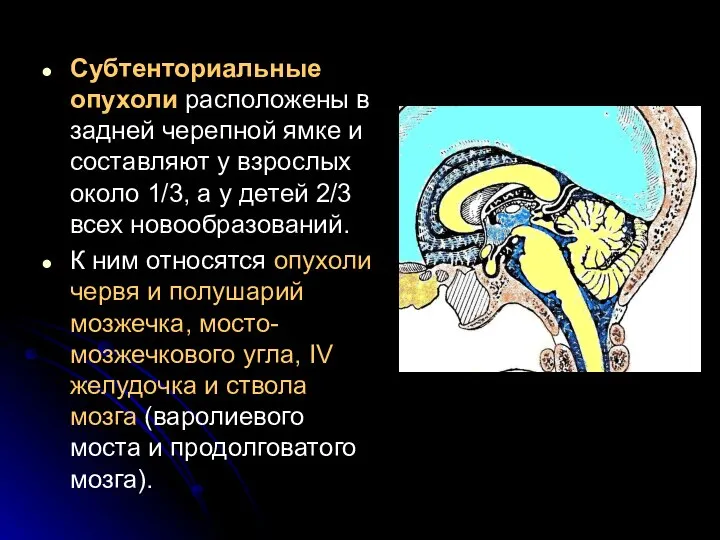 Субтенториальные опухоли расположены в задней черепной ямке и составляют у взрослых