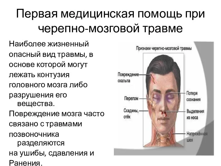 Первая медицинская помощь при черепно-мозговой травме Наиболее жизненный опасный вид травмы,