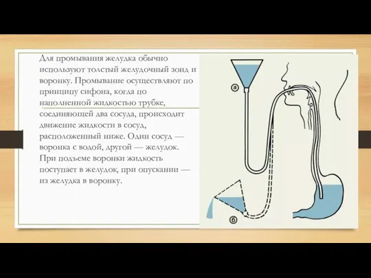 Для промывания желудка обычно используют толстый желудочный зонд и воронку. Промывание