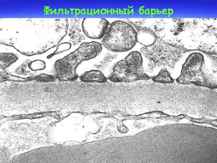 Фильтрационный барьер