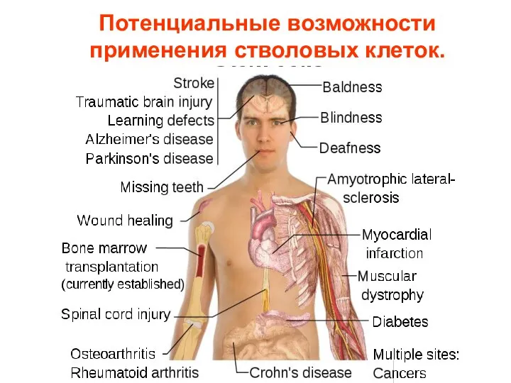 Потенциальные возможности применения стволовых клеток.